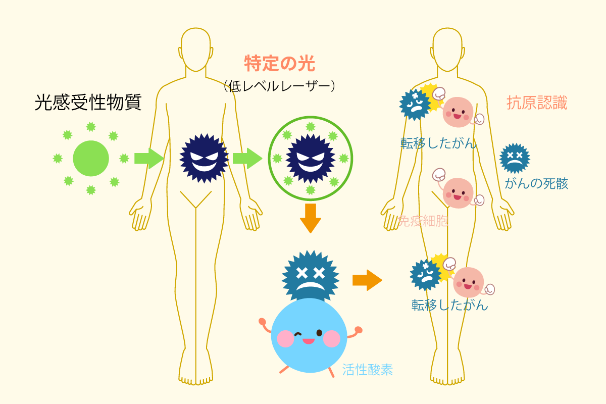 がん光免疫療法 特定の光（低レベルレーザー）を照射